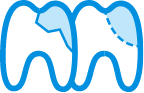 Dessin de 2 dents illustrant l'extraction et le traitement des dents dans le cadre de la chirurgie dentaire.